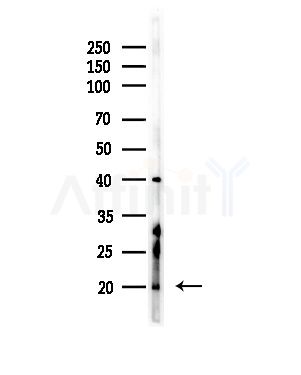 Lysozyme Antibody - Western blot analysis of lysates from RAW264.