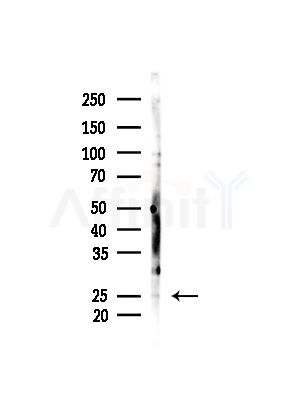 Hemoglobin subunit alpha Antibody - Western blot analysis of lysates from COLO205 cells(heat-shock,45min treatment), using Hemoglobin subunit alpha Antibody at 1/1000 dilution.