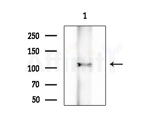 ROR2 Antibody - Western blot analysis of extracts from B16F10-LUC cells(heat-shock treatment), using ROR2 Antibody at 1/1000 dilution.