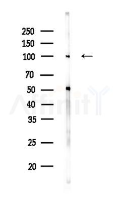 ROR2 Antibody - Western blot analysis of lysates from 3T3-L1 P6(LPS,4h treatment), using ROR2 Antibody at 1/1000 dilution.