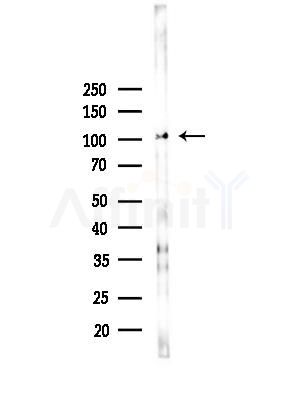 ROR2 Antibody - Western blot analysis of lysates from B16F10-LUC cells(heat-shock,45min treatment), using ROR2 Antibody at 1/1000 dilution.