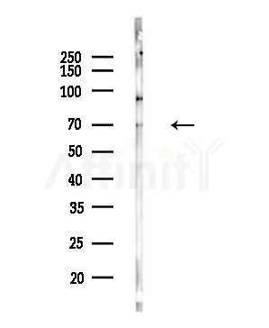 EYA2 Antibody - Western blot analysis of lysates from COLO205 cells(UV,30min treatment), using EYA2 Antibody at 1/1000 dilution.