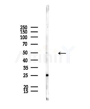 EYA2 Antibody - Western blot analysis of lysates from Rat liver, using EYA2 Antibody at 1/1000 dilution.
