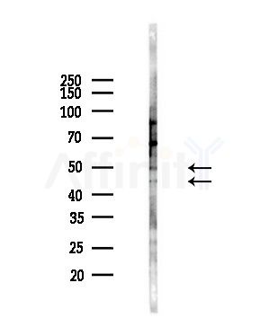 CD72 Antibody - Western blot analysis of lysates from Hela cells(heat-shock,45min treatment), using CD72 Antibody at 1/1000 dilution.