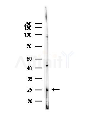WARS Antibody - Western blot analysis of lysates from LoVo cells(heat-shock,45min treatment), using WARS Antibody at 1/1000 dilution.