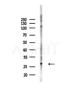 CEND1 Antibody - Western blot analysis of lysates from Hela cells(starvation,24h treatment), using CEND1 Antibody at 1/1000 dilution.