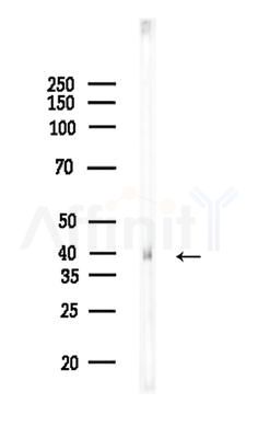 EGLN2 Antibody - Western blot analysis of lysates from Rat lung, using EGLN2 Antibody at 1/1000 dilution.