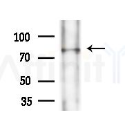 CGB Antibody - Western blot analysis of extracts from B16F10-LUC cells(heat-shock,45min treatment), using CGB Antibody at 1/1000 dilution.