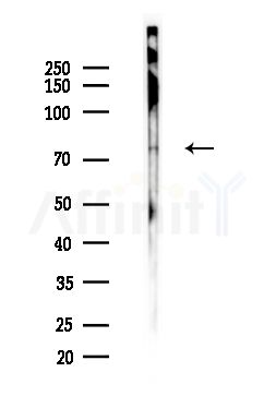 CGB Antibody - Western blot analysis of lysates from B16F10-LUC cells(heat-shock,45min treatment), using CGB Antibody at 1/1000 dilution.