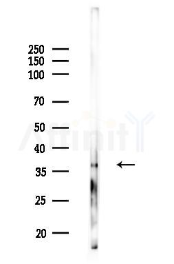 BRCC3 Antibody - Western blot analysis of lysates from Hela cells(LPS 4h treatment), using BRCC3 Antibody at 1/1000 dilution.