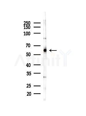 EHD1 Antibody - Western blot analysis of lysates from COLO205 cells(heat-shock,45min treatment), using EHD1 Antibody at 1/1000 dilution.