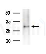 MESDC2 Antibody - Western blot analysis of extracts from PC12 cells(LPS,4h treatment), using MESDC2 Antibody at 1/1000 dilution.