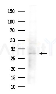 MESDC2 Antibody - Western blot analysis of extracts from HepG2 cells(heat-shock treatment), using MESDC2 Antibody at 1/1000 dilution.