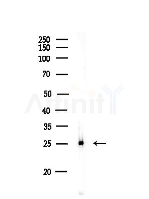 MXD3 Antibody - Western blot analysis of lysates from Rat lung, using MXD3 Antibody at 1/1000 dilution.
