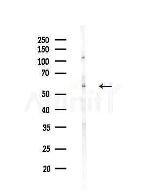 FSCN1 Antibody - Western blot analysis of lysates from EC304 cells(heat-shock treatment), using FSCN1 Antibody at 1/1000 dilution.