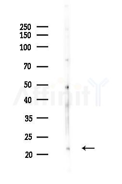 ARFRP1 Antibody - Western blot analysis of lysates from Hela cells(LPS 4h treatment), using ARFRP1 Antibody at 1/1000 dilution.