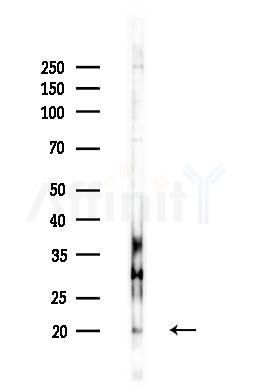ARFRP1 Antibody - Western blot analysis of lysates from B16F10-LUC cells(heat-shock,45min treatment), using ARFRP1 Antibody at 1/1000 dilution.