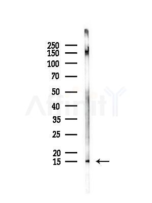 UBA52 Antibody - Western blot analysis of lysates from Hela cells(heat-shock,45min treatment), using UBA52 Antibody at 1/1000 dilution.