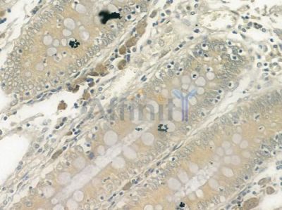 DAPK1 Antibody - DF8030 at 1/100 staining human normal colon tissue by IHC-P.