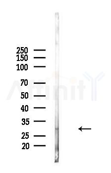 CD81 Antibody - Western blot analysis of lysates from Mouse brain, using CD81 Antibody at 1/1000 dilution.