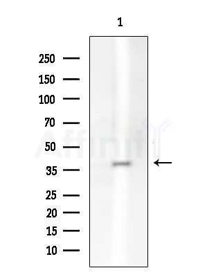 GPA33 Antibody - Western blot analysis of extracts from EC304 cells, using GPA33 Antibody at 1/1000 dilution.