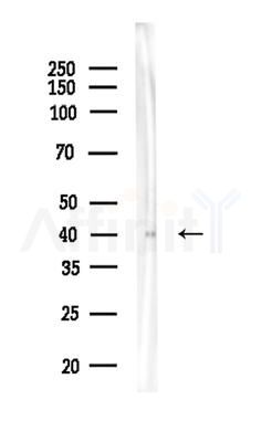 GPA33 Antibody - Western blot analysis of lysates from EC304 cells, using GPA33 Antibody at 1/1000 dilution.