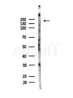 TNC Antibody - Western blot analysis of lysates from Hela cells(starvation,24h treatment), using TNC Antibody at 1/1000 dilution.