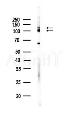 CLSTN1 Antibody - Western blot analysis of lysates from 3T3-L1 P6(LPS,4h treatment), using CLSTN1 Antibody at 1/1000 dilution.