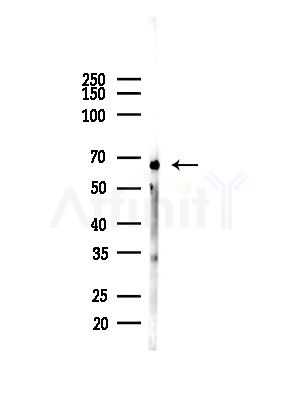 YY1 Antibody - Western blot analysis of lysates from COLO205 cells(heat-shock,45min treatment), using YY1 Antibody at 1/1000 dilution.