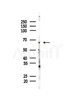 YY1 Antibody - Western blot analysis of lysates from MDA-MB-231 cells(heat-shock,45min treatment), using YY1 Antibody at 1/1000 dilution.