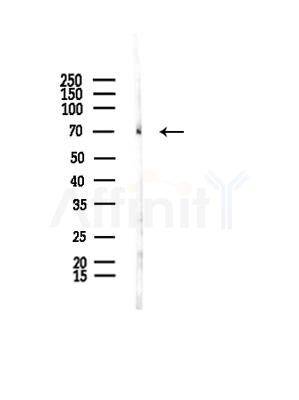 TRIP10 Antibody - Western blot analysis of lysates from B16F10-LUC cells(UV,30min treatment), using TRIP10 Antibody at 1/1000 dilution.