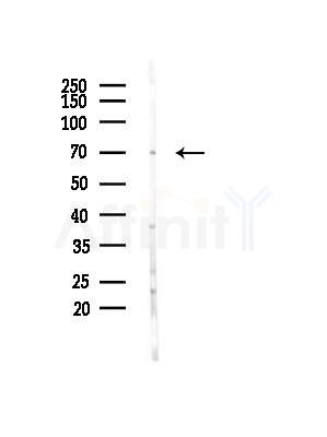 TRIP10 Antibody - Western blot analysis of lysates from Mouse liver, using TRIP10 Antibody at 1/1000 dilution.