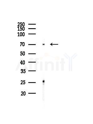 TRIP10 Antibody - Western blot analysis of lysates from MDA-MB-231 cells(heat-shock,45min treatment), using TRIP10 Antibody at 1/1000 dilution.
