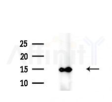 Galectin 1 Antibody - Western blot analysis of extracts from B16F10-LUC cells(UV, 30min treatment), using Galectin 1 Antibody at 1/1000 dilution.