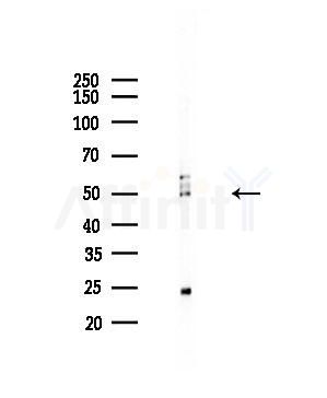 EVL Antibody - Western blot analysis of lysates from 293 cells(starvation,24h treatment), using EVL Antibody at 1/1000 dilution.