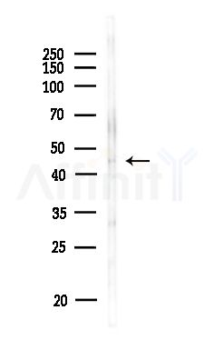 LIS1 Antibody - Western blot analysis of lysates from MDA-MB-231 cells(heat-shock,45min treatment), using LIS1 Antibody at 1/1000 dilution.