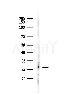 CLEC3B Antibody - Western blot analysis of lysates from LoVo cells(heat-shock,45min treatment), using CLEC3B Antibody at 1/1000 dilution.