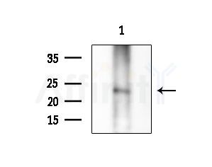 CITED2 Antibody - Western blot analysis of extracts from K562 cells(heat-shock treatment), using CITED2 Antibody at 1/1000 dilution.