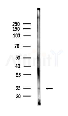 CITED2 Antibody - Western blot analysis of lysates from K562 cells(heat-shock treatment), using CITED2 Antibody at 1/1000 dilution.