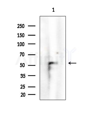 FOXA1 Antibody - Western blot analysis of extracts from EC304 cells, using FOXA1 Antibody at 1/1000 dilution.
