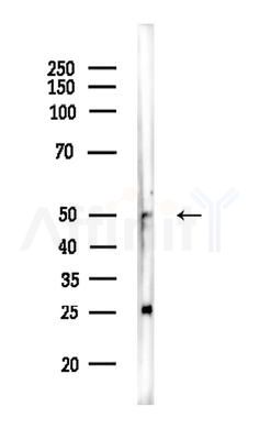 FOXA1 Antibody - Western blot analysis of lysates from EC304 cells, using FOXA1 Antibody at 1/1000 dilution.