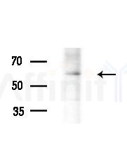BORA Antibody - Western blot analysis of extracts from Mouse testis, using BORA Antibody at 1/1000 dilution.