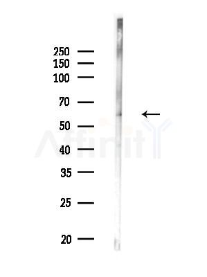 BORA Antibody - Western blot analysis of lysates from Mouse testis, using BORA Antibody at 1/1000 dilution.