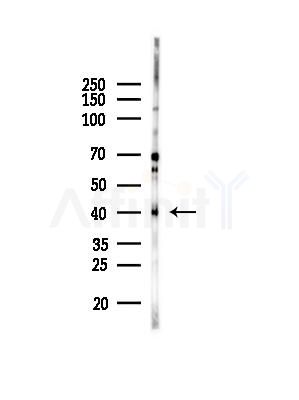 MBD2 Antibody - Western blot analysis of lysates from EC304 cells(heat-shock,45min treatment), using MBD2 Antibody at 1/1000 dilution.