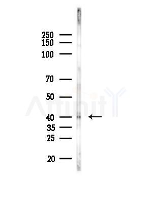 MBD2 Antibody - Western blot analysis of lysates from PC12 cells(LPS, 4h treatment), using MBD2 Antibody at 1/1000 dilution.