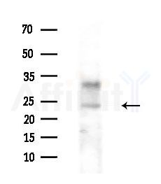 UBE2L6 Antibody - Western blot analysis of extracts from Rat lung, using UBE2L6 Antibody at 1/1000 dilution.