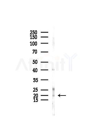 UBE2L6 Antibody - Western blot analysis of lysates from Rat lung, using UBE2L6 Antibody at 1/1000 dilution.