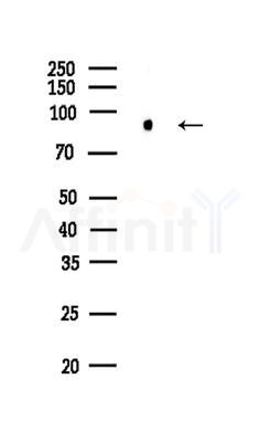 CD97 Antibody - Western blot analysis of lysates from Mouse brain, using CD97 Antibody at 1/1000 dilution.
