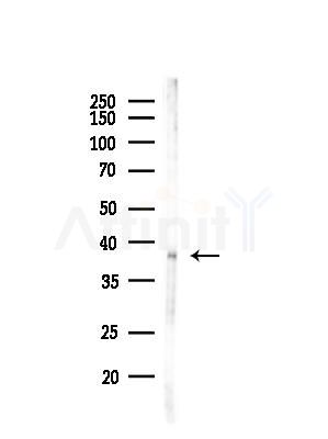 CD7 Antibody - Western blot analysis of lysates from PC12 cells(LPS, 4h treatment), using CD7 Antibody at 1/1000 dilution.