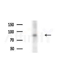 PI4KB Antibody - Western blot analysis of lysates from Hela cells(starvation,24h treatment), using PI4KB Antibody at 1/1000 dilution.